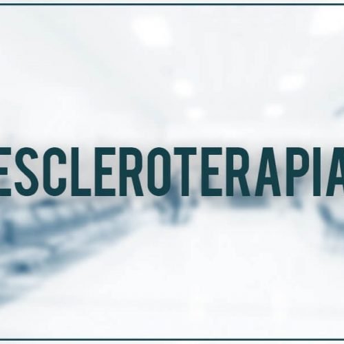 Escleroterapia