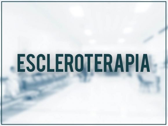 Escleroterapia