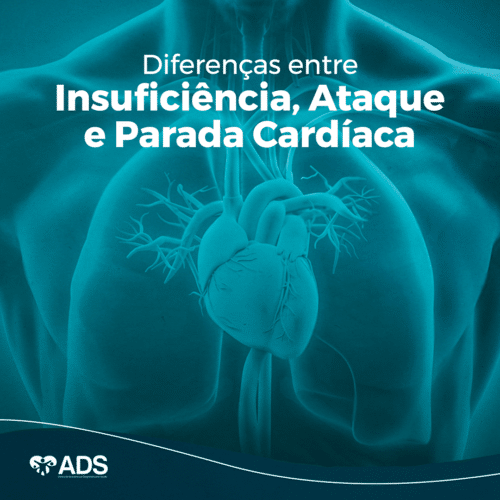 Diferenças entre Insuficiência, Ataque e Parada Cardíaca